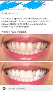 More images for how to use hydrogen peroxide to whiten teeth » Does Hydrogen Peroxide Whiten Teeth Reddit Teethwalls