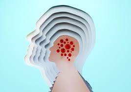 Adam explores the emerging science behind 'long covid' and asks what the repercussions might be for patients, for the nhs and for society. What Is Long Covid And How Do You Treat It Cnet
