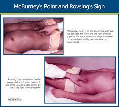 We may suspect appendicitis not diagnositic: Appendicitis Nursing Care Management Study Guide