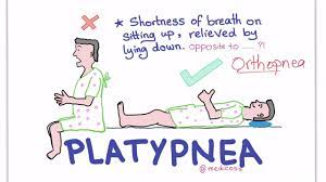Platypnea Orthodeoxia Syndrome Youtube
