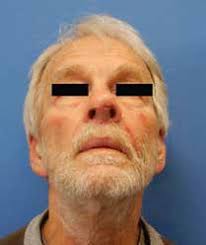 HEAD & NECK INSTITUTE