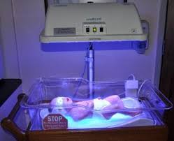 Image result for Phototherapy