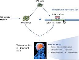 Cell Based Therapies For Huntington S Disease Semantic Scholar