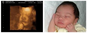 We did not find results for: Before And After 3d Ultrasound Images