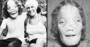 Rocky Dennis: The True Story Of The Boy Who Inspired 'Mask'