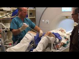 Survivors talk about their journey with prostate cancer. Destroying Prostate Cancer With Novel Noninvasive Mri Guided Ultrasound Treatment