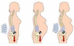 Lower Back Pain During Pregnancy Third Trimester Problem Lyios Com