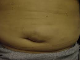 Image result for Umbilicus