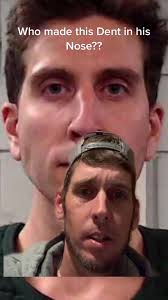 Mysterious Nose Dent Investigation in Idaho