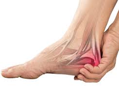 Image result for gout