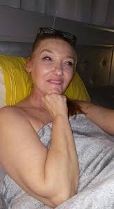 My Journey With Stage 4 Metastatic Squamous Cell Carcinoma In Situ Cancer