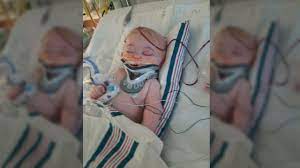 Baby falling off bed brain damage. Infant Suffers Brain Damage After Falling Off Bed Fox News Video
