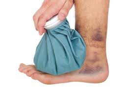 Here you can find a guide on how to treat a turf toe. What Is Turf Toe Bend Mend Physiotherapy And Pilates In Sydney S Cbd