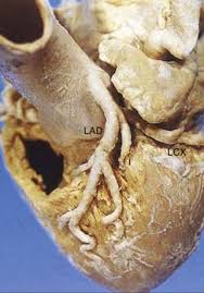 Normal Heart Thoracic Pathology A Volume In The High Yield Pathology Series Expert Consult Online And Print 1st Edition