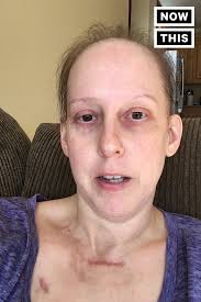 Trump Blocks Stage 4 Cancer Patient On Twitter