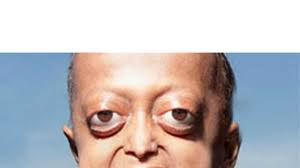 Image result for progeria case in bihar
