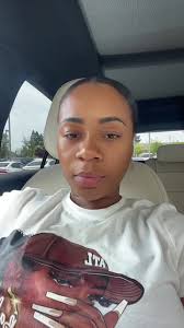 Chemical Peel in Las Vegas Black Skin