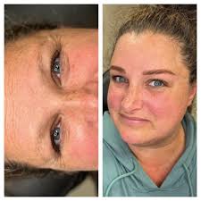 Who are the best plastic surgeons in Michigan for things like, brow lift  and fat transfers?