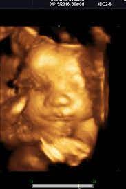 4d ultrasound pictures 30 weeks. 30 Weeks 4d Of A Beautiful Baby Boy Edison Light Bulbs Beautiful Babies Beautiful