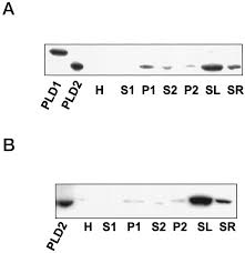 It is not intended for promotion any illegal things. Cardiac Phospholipase D2 Localizes To Sarcolemmal Membranes And Is Inhibited By A Actinin In An Adp Ribosylation Factor Reversible Manner Journal Of Biological Chemistry