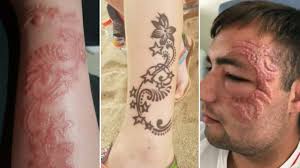 However, until recently henna tattoo creation was almost exclusively an indian art. Dangerous Black Henna Tattoos Leaving Bali Tourists With Permanent Scars