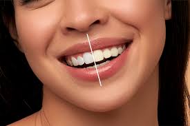 Understanding the Teeth Whitening Process | Oakleigh Dental