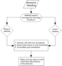 Image result for Active Management of Labor