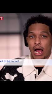 Greg Books Full Injury of The Video