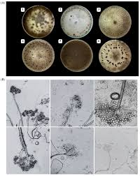 Image result for Botrytis cinerea
