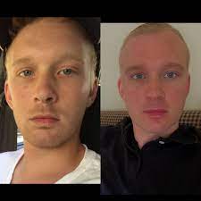 This is so for at least two reasons. 1 Year Transformation Started Taking Prozac Quit Smoking Cigarettes And Weed After 10 Years Daily Use Cut Out 95 Of Alcohol Consumption Cleaner Diet And Exercise Just The Beginning Happy