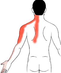 椎間板ヘルニアとは？ - 遠藤聡