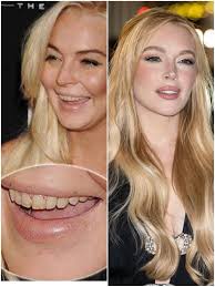 Bekis of Pageantry atbp.