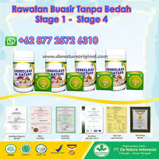 Buasir atau hemoroid adalah pembengkakan pada vena yang terletak di bahagian rektum dan dubur. Storymapjs Review Ubat Kecut Buasir Berkesan