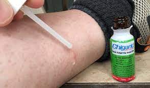 They are very resistant and they are hard to remove. How To Treat Chigger Bites
