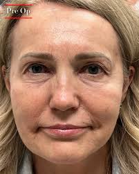 👍🏼👍🏼👍🏼