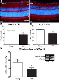 To Unite Or Divide Mitochondrial Dynamics In The Murine Outer Retina That Preceded Age Related Photoreceptor Loss Oncotarget