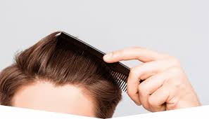 Men's genetic thinning will often manifest itself in the temples when we are talking about the front of the scalp. Ds Laboratories Is Thinning Hair At The Temples A Sign Of Hair Loss Milled
