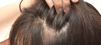 Marotta suggests you take about 60 hairs between your fingers and pull a little bit as you run your fingers through your hair. Signs Your Hair Is Thinning International Hair Studio