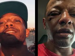 Fundraiser for Anthony Espinoza by Anthony Espinoza : Justice for Anthony:  Support His Recovery