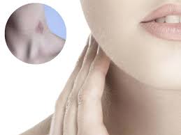 Cara menghilangkan noda bekas coretan di layar datar televisi terganggu dengan noda coretan di layar led televisi anda? Cara Hilangkan Kesan Gigitan Di Leher Pesona Pengantin