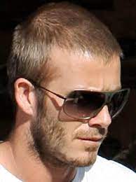 Balding Gracefully Tips And Hairstyles For Balding Men Thin Hair Men Hair Loss Men Haircuts For Balding Men