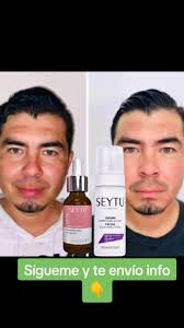 manchasdesol #manchasdeacne #manchas #manchasdeembarazo #hipoalergeni...