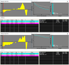 Retroperitoneal margin involvement by adenocarcinoma of the caecum and ascending colon: Frontiers Impact Of Surgical Margin On The Prognosis Of Early Hepatocellular Carcinoma 5 Cm A Propensity Score Matching Analysis Medicine
