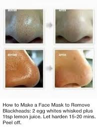 How To Get Rid Of Blackheads Beauty Hacks Beauty Care Blackheads On Nose