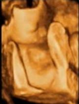 Der schleimpfropf ist genau das: 8 Anzeichen Dass Die Geburt Beginnt Seite 2 Babywelten Ch