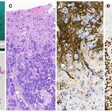 Macroscopic and microscopic images. A Macroscopic appearance of the...