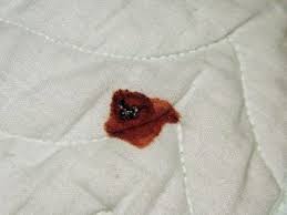 Wie entsteht schimmel auf matratzen? Matratze Reinigen Anleitungen Um Urin Schweiss Flecken Zu Entfernen