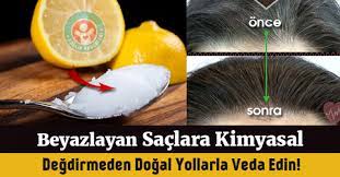 Beyazlayan Sac Tekrar Siyahlasir Mi Sactaki Beyazlar Nasil Yok Olur Beyaz Sac Sac Saglikli Sac