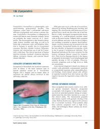 Image result for Erysipeloid