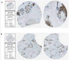 It is meant to signify survivors of cancer, as well. The Figure Represents Antibody Staining Immunohistochemical Images Of Download Scientific Diagram